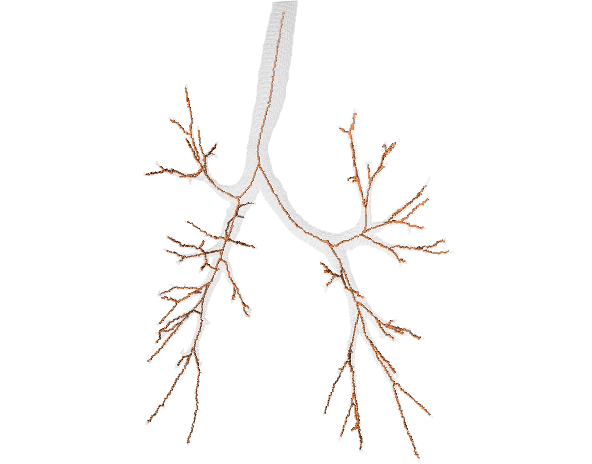 Bronchi
