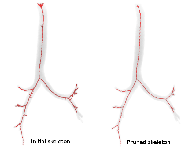 Noisy tube